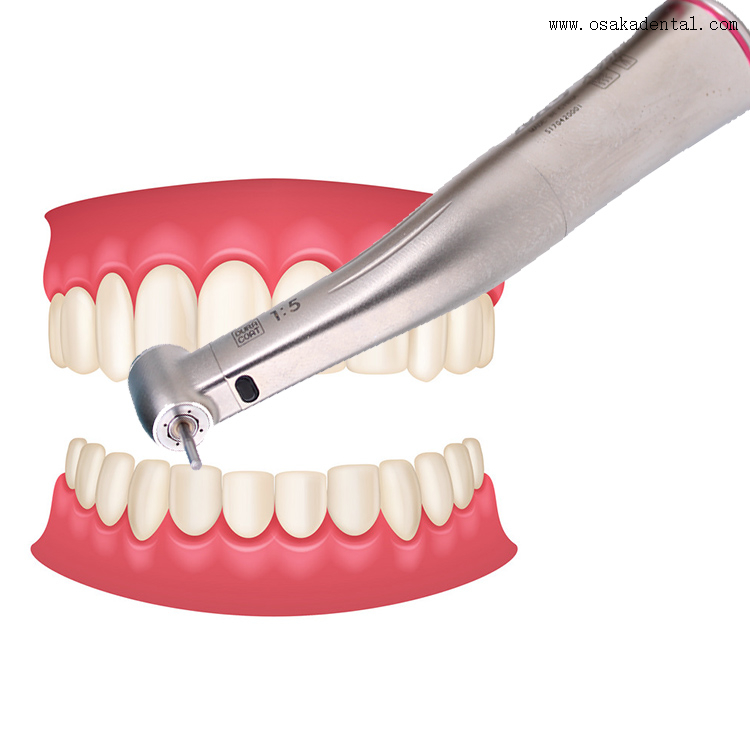 Contra Angle Dental Handpiece with Fiber Optic 15 Buy Contra Angle