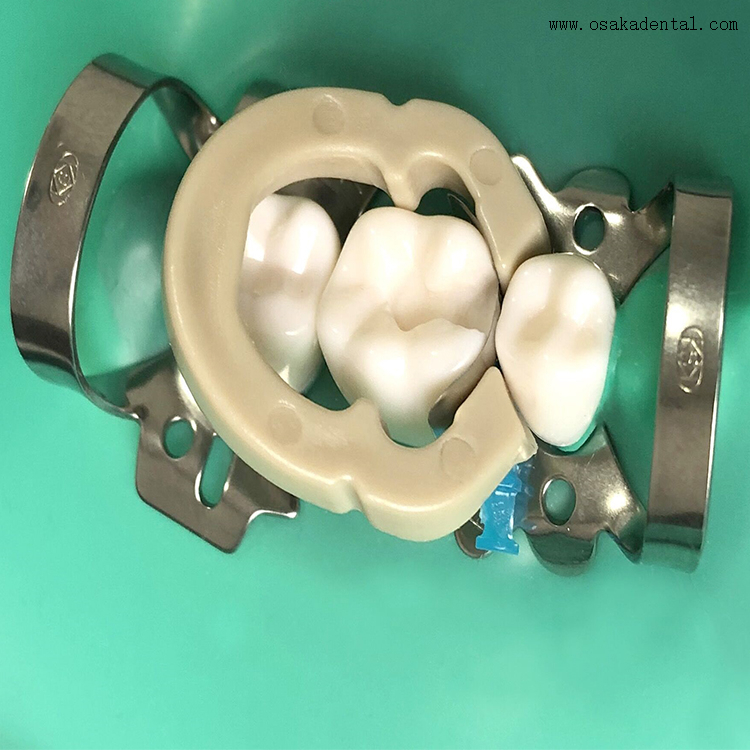 Dental Tight Contacted Sectional Matrix Band Buy Sectional Matrix