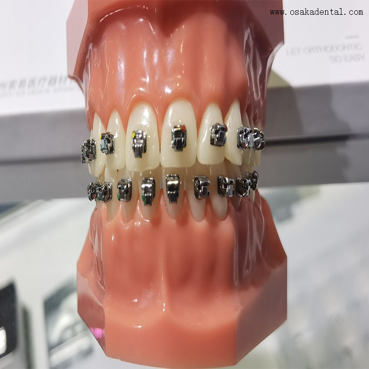 Dental Selfligating Metal Bracket for Dental Orthodontic Buy Dental