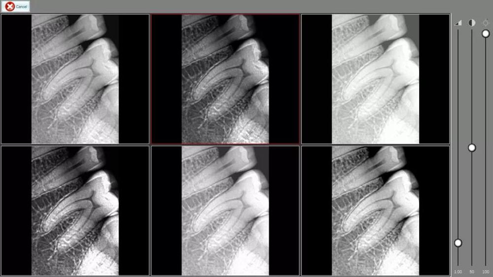 dental Trident sensor/rundeer sensor dental RVG SIZE 1.5 x ray sensor