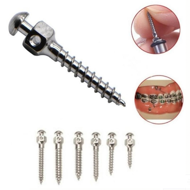 Dental Orthodontic Titanium Alloy Micro Implant Selfdrilling
